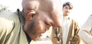 Žmogus „dramblys” iš Pakistano