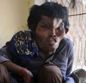 Sain Mumtaz elephant man