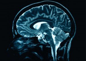 brain06_