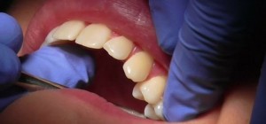 teeth